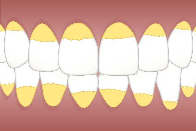 white spots on teeth